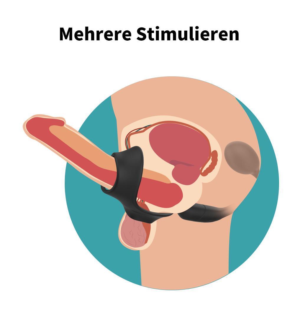 FATNES Kablosuz Kumandalı Testis ve Penis Halkalı Perine ve Prostat Uyarıcı Vibratör